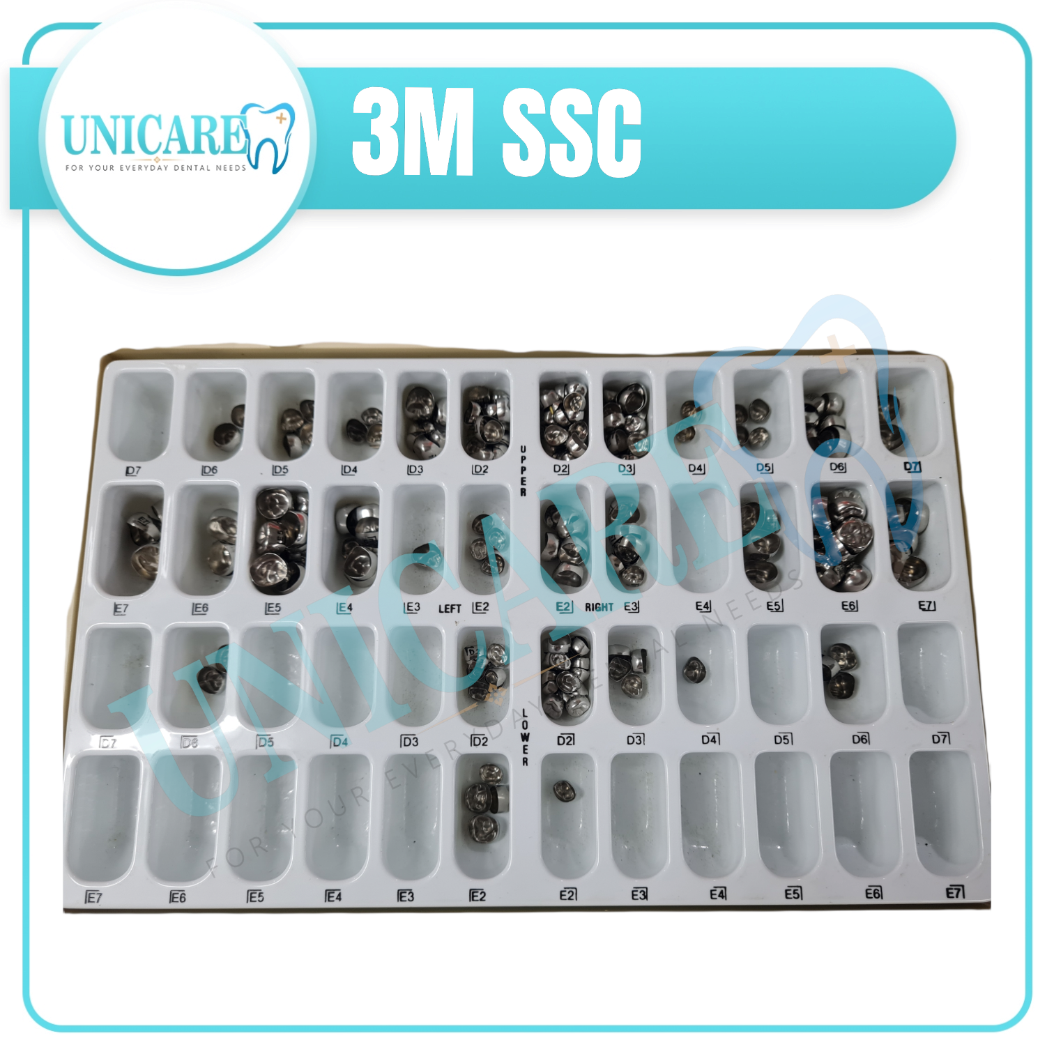 Stainless Steel Crown or SSC – Unicare Dental Medical Supply